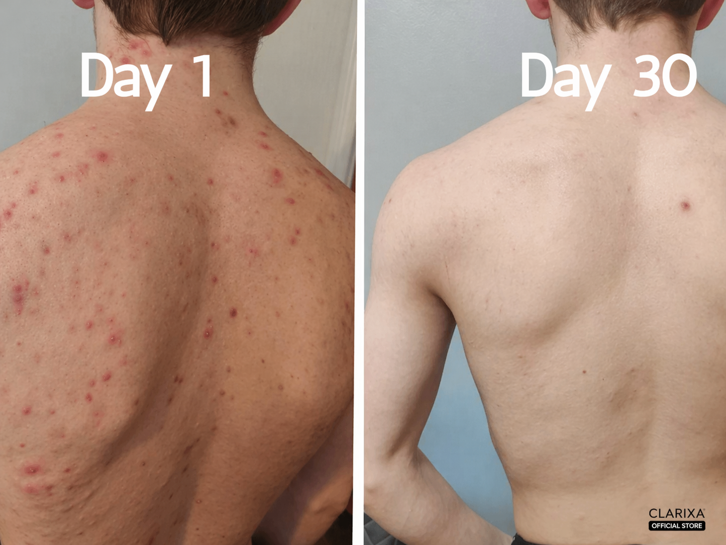 Clarixa 30-Day Clear Skin Body Wash