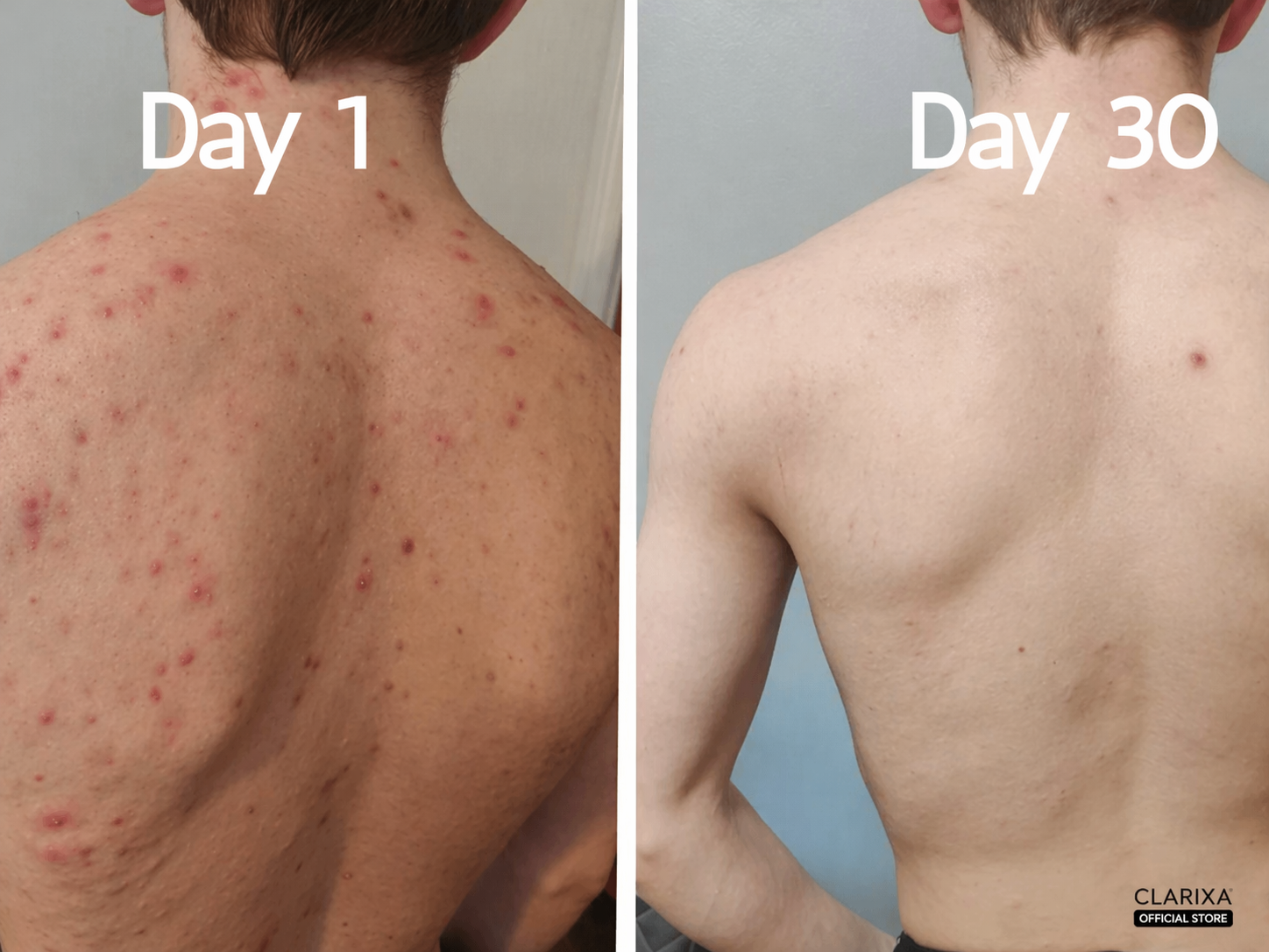 Clarixa 30-Day Clear Skin Body Wash