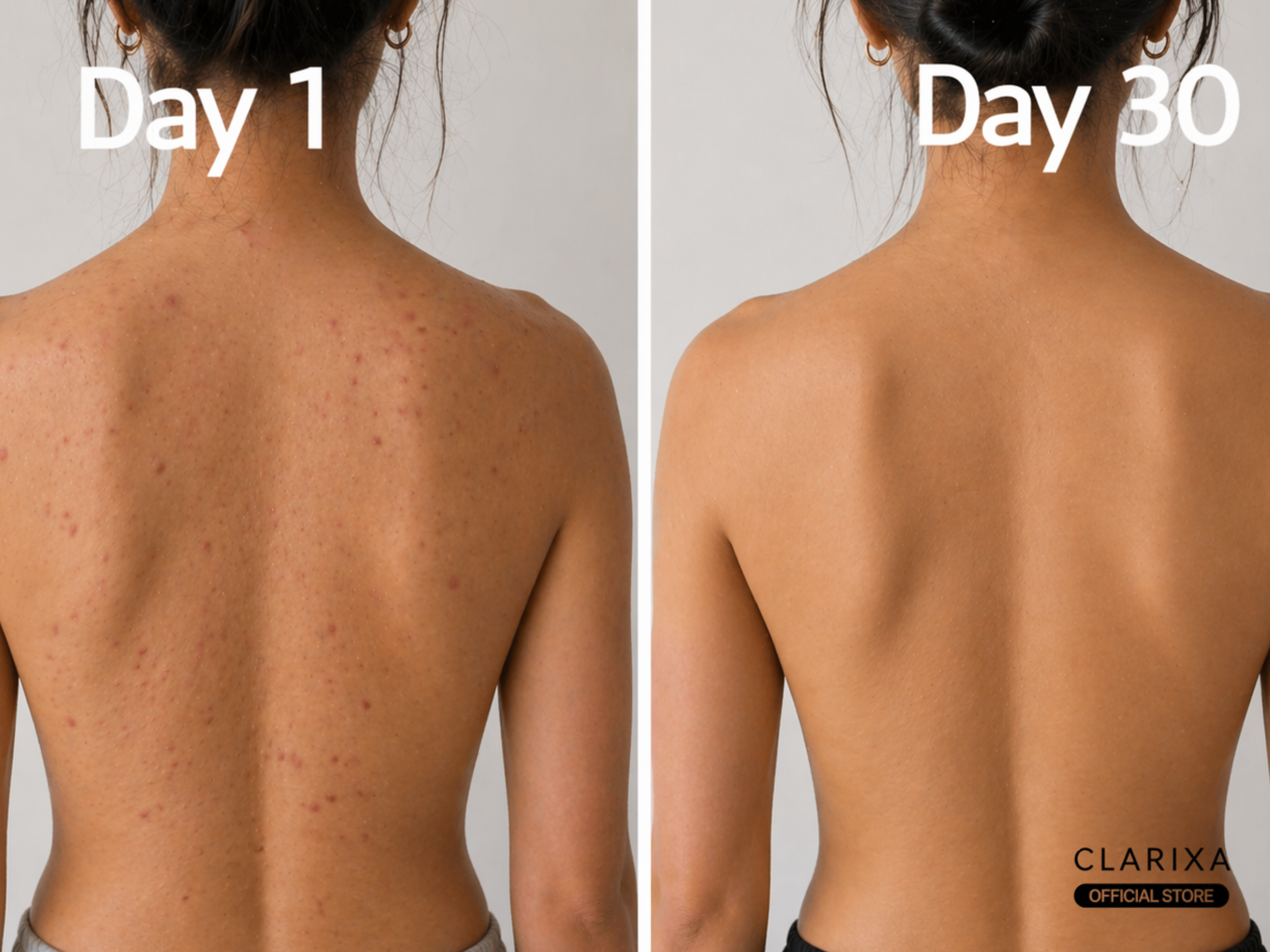 Clarixa 30-Day Clear Skin Body Wash